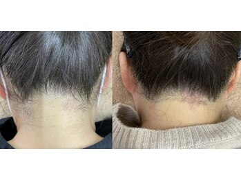 ナノハナ/鹿沼市全身脱毛美容室ナノハナ