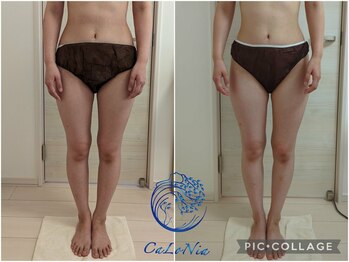 カロニア(CaLoNia)/骨盤歪み・ボディバランス調整