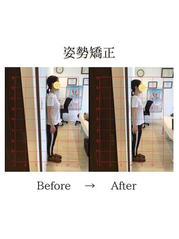 心斎橋長堀フェムテック整骨院/42姿勢矯正　骨格矯正と骨盤矯正