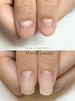 マリーロール 淀屋橋本店(Marie Laure)/自爪育成/深爪矯正/ネイルケア