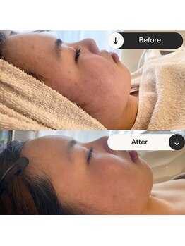 シグネット(Cygnet)/CHRISTINA/アンストレス