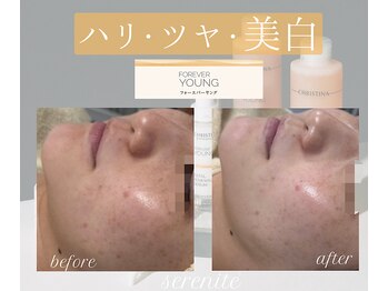 セレニテ(Serenite)/フォーエバーヤング