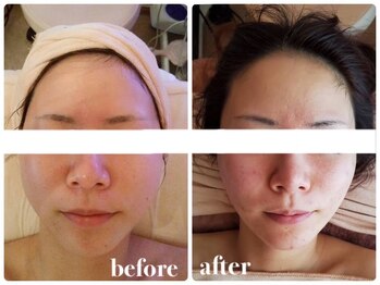 フェイス 本店 盛岡岩手(FACE)/