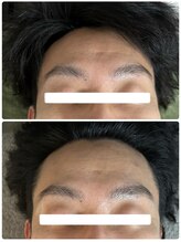 ビジュープラス 幸手店(Bijou+)/REVI陶肌トリートメント