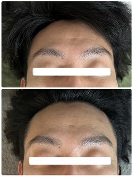 ビジュープラス 幸手店(Bijou+)/REVI陶肌トリートメント