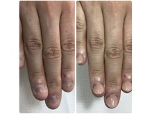 ネイルアンバー 西向田店(Nail amber)/施術当日の変化