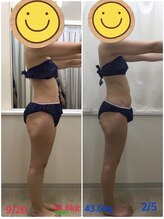 エスティフル 狭山店(ESTIFUL)/[痩身エステ]Before/After