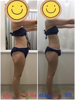 エスティフル 狭山店(ESTIFUL)/[痩身エステ]Before/After