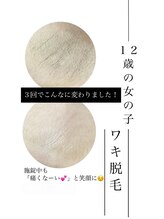 リードエピア(LEADepiA)/10才から出来るキッズ脱毛