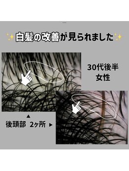 エルプラス(L+)/白髪の根元が黒くなりました！