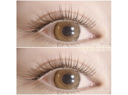 アイリズム(eye.Rizm)の写真