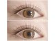 アイリズム(eye.Rizm)の写真