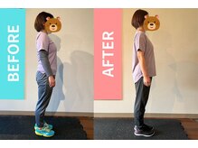 アクト(ACT)/ビフォーアフター