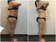 美容整体ウェリナ 名駅院/小顔矯正/骨盤矯正/美脚サロン