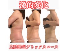 タマンサリ(Taman Sari)の雰囲気（本気ダイエット最後にしませんか？サイズダウン専門店にお任せ☆）