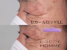 エサージュオム 銀座エスト店/メンズまつ毛パーマ