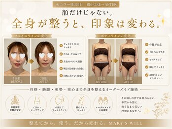 マリーズウィル(MARY's WILL)の写真/\歪み矯正×独自技術/機器施術やジムで諦めた二の腕と贅肉に、最後の一手を。華奢肩×首長×首肩、爆軽!
