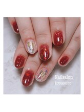 トレジャー(treasure)/