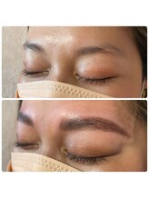 ジェミニ(Gemini)/眉に傷があっても大丈夫＾＾