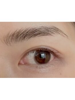 顔脱毛がしたい