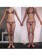 レナトゥス 銀座(Renatus)/BeforeAfter【痩身/東京/銀座】