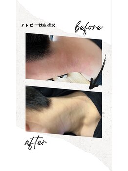 ベル(Belle)/無料カウンセリング￥0