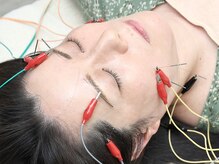 はりきゅう花桃の雰囲気（電気を流すお顔の美容鍼）