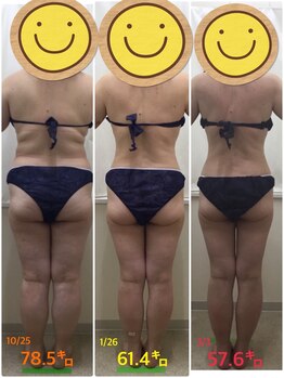 エスティフル 狭山店(ESTIFUL)/[痩身エステ]Before/After