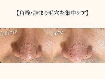 ドリームスパ 町田店(DREAM SPA)/before→after