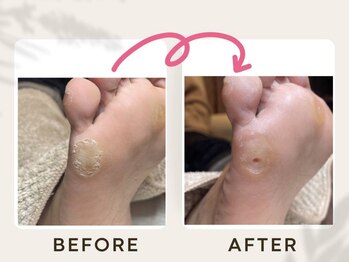 ドクターネイル爪革命 恵庭店/