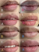 トータルクリア(TOTAL CLEAR)/DOLL PINK