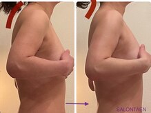 サロン タエン/巻き肩・猫背改善！首すっきり