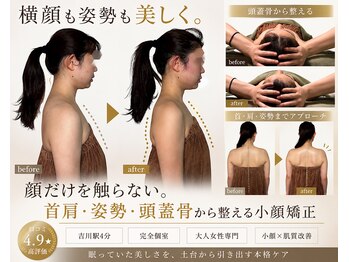 スカイ(sky)の写真/首肩から整えて叶える頭蓋骨立体小顔矯正