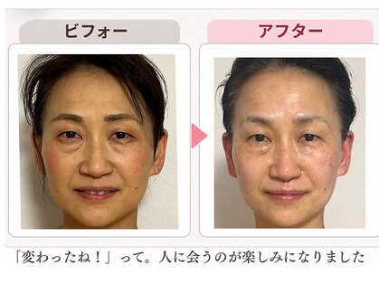美カナエル(美kanaeru)の写真