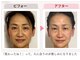 美カナエル(美kanaeru)の写真