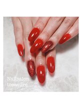 トレジャー(treasure)/