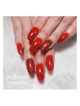 トレジャー(treasure)/