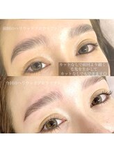 アンナボーテ(Anna beate)/ハリウッドブロウリフト