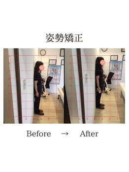 心斎橋長堀フェムテック整骨院/41姿勢矯正　骨格矯正と骨盤矯正