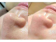 サロンドリー(salon de Re)/超音波エクストラクション