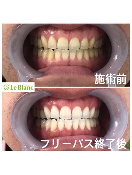 ルブラン 奈良店(Le Blanc)/男性のお客様!本日終了(^ ^)