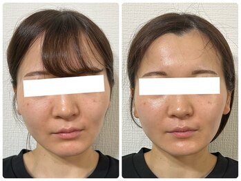 イロドリ ボディ アンド フェイス(irodori. body & face)/ただの小顔矯正ではありません