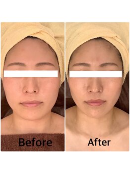 スペチアーレ 夙川/小顔と美肌が手に入る