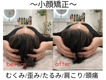 エール シガ(AILE SHIGA)/【小顔矯正】