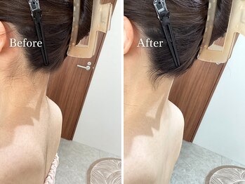 エリー(Ellie)/結婚式前は必須のシェービング！