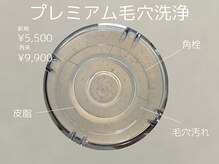 リモア(REMORE)/お顔のごわつき一掃