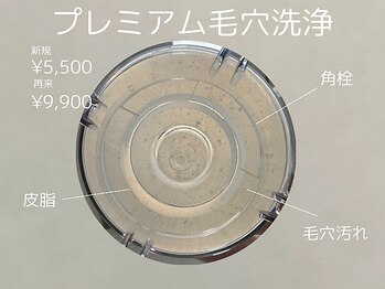 リモア(REMORE)/お顔のごわつき一掃