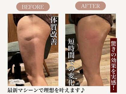 ナッティ(natti)の写真