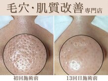 シエール 調布(Ci'aile)