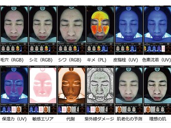 サロンドソフィア 麻布十番(salon de Sophia)の写真/【肌診断機で可視化】長期的な肌と身体の健康をサポート。丁寧なカウンセリングで寄り添う本命サロンへ◎